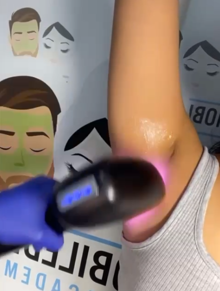 Mobile Derma | Laser