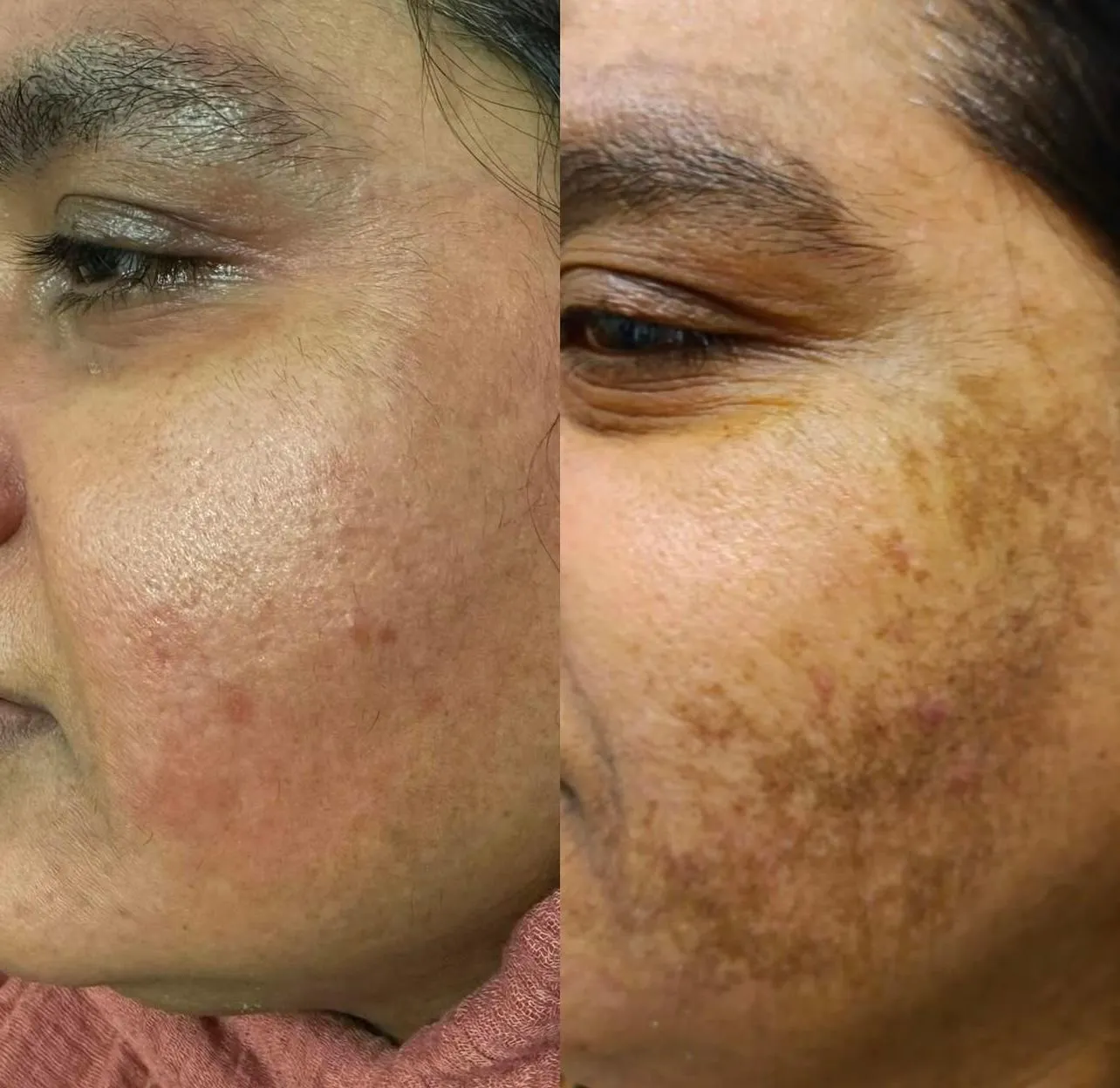 MobileDerma Oldham