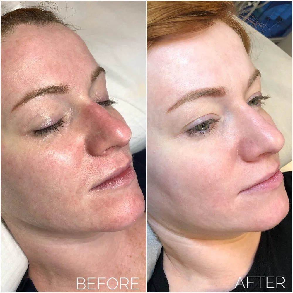 MobileDerma Oldham